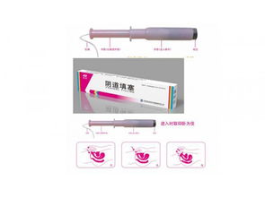 陰道填塞 醫保收費婦科耗材